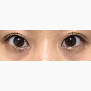 品川スキンクリニック立川院口コミ