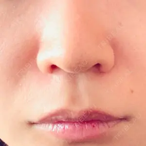 山本クリニック口コミ
