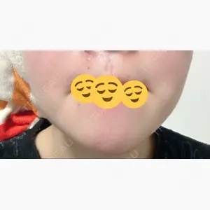ノリス美容クリニック口コミ