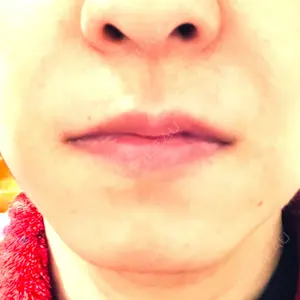 聖心美容クリニック 札幌院口コミ