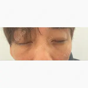 東郷美容形成外科 福岡口コミ