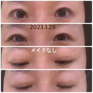 こいずみ形成クリニック名古屋口コミ