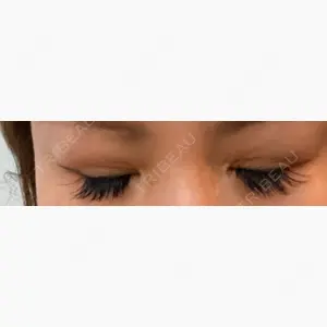 Beauty Clinic the GINZA口コミ
