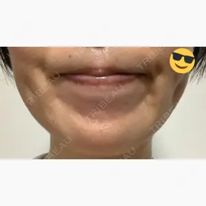 ユウコ形成外科クリニック口コミ
