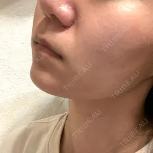 レナータクリニック 立川院口コミ