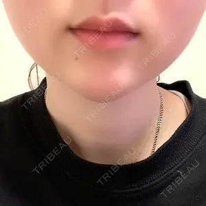 銀座みゆき通り美容外科 大阪梅田院口コミ