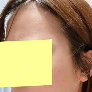 美容皮膚科エルムクリニック 福岡院口コミ