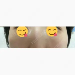 品川スキンクリニック表参道院口コミ