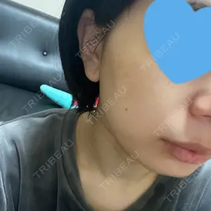 Rosa Beauty Clinic口コミ