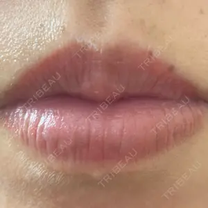 こいずみ形成クリニック名古屋口コミ