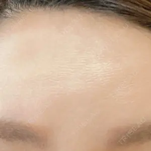 Rosa Beauty Clinic口コミ