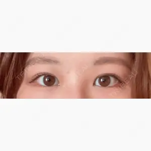 水の森美容クリニック 大阪梅田院口コミ