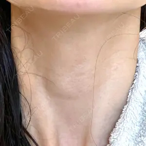 ももスキンケアクリニック口コミ