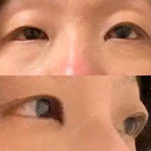 表参道タウン形成外科クリニック口コミ