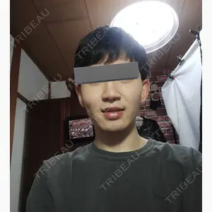 アサミ美容外科 大阪院口コミ