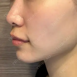 The Natural Beauty Clinic 恵比寿院口コミ