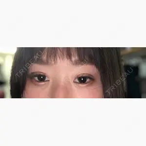 銀座みゆき通り美容外科 大阪梅田院口コミ