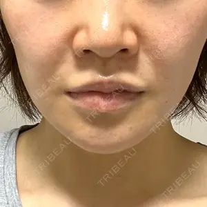 TCB東京中央美容外科 横浜駅前院口コミ