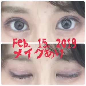ヒルズ美容クリニック口コミ