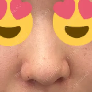 ヴェリテクリニック 銀座院口コミ