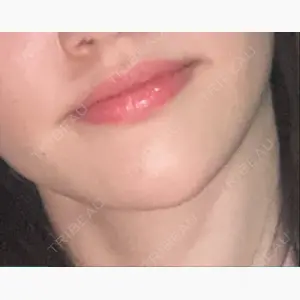 銀座みゆき通り美容外科 大阪梅田院口コミ