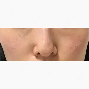 LOUIS CLINIC 二子玉川院【ルイクリニック】口コミ