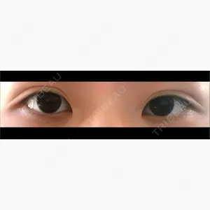 共立美容外科 新宿本院口コミ