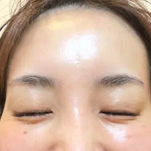 ももスキンケアクリニック口コミ