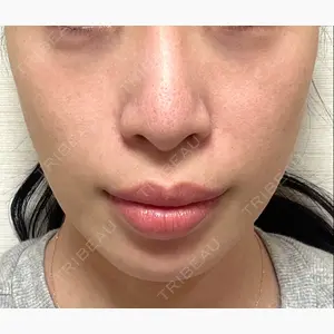 東京美容クリニック 表参道本院口コミ