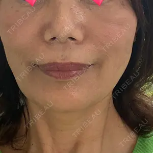 ノリス美容クリニック口コミ