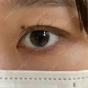 水の森美容クリニック 東京新宿院口コミ