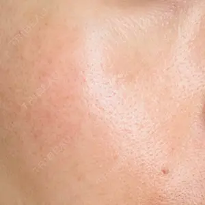 美容皮膚科エルムクリニック 広島院口コミ