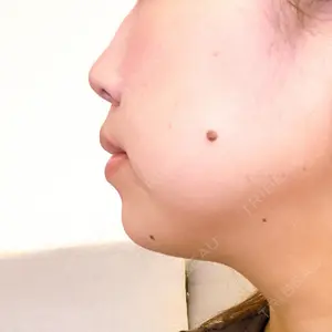 銀座みゆき通り美容外科 大阪梅田院口コミ