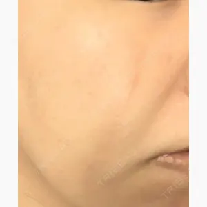 品川美容外科 町田院口コミ