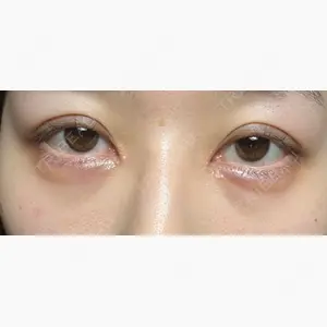 湘南美容クリニック 大阪梅田本院口コミ