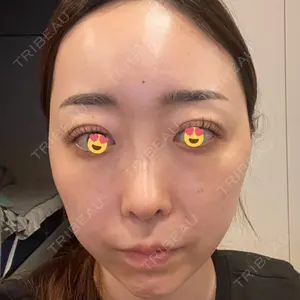 エイペックス美容外科口コミ