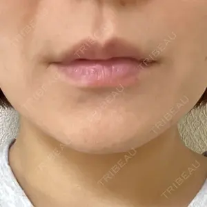 東京美容外科 仙台院口コミ