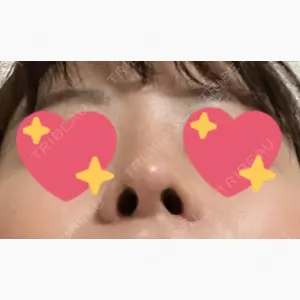 Zetith Beauty Clinic 銀座院口コミ