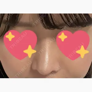 Zetith Beauty Clinic 銀座院口コミ