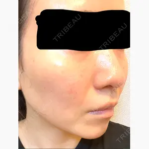 東京美容クリニック 表参道本院口コミ