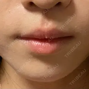 ドクターゴールドマンクリニック 大阪院口コミ