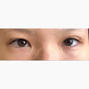 東京皮膚科・形成外科 (銀座いけだクリニック)口コミ