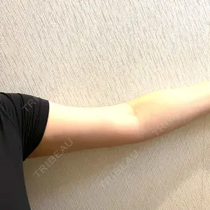 大阪雅美容外科口コミ
