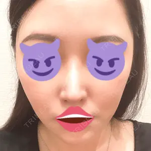 プリモ麻布十番クリニック口コミ