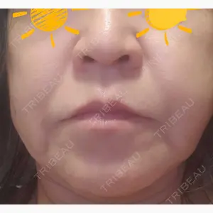 エースクリニック 名古屋院口コミ