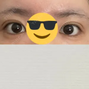 東京イセアクリニック口コミ