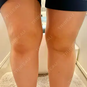 Anterior 大阪梅田院口コミ