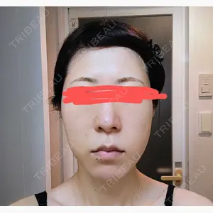 グローバルビューティークリニック 大阪院口コミ