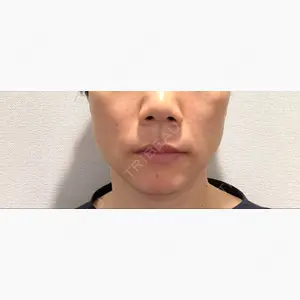 東郷美容形成外科 福岡口コミ