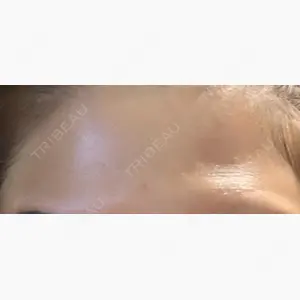 エートップ美容整形外科口コミ